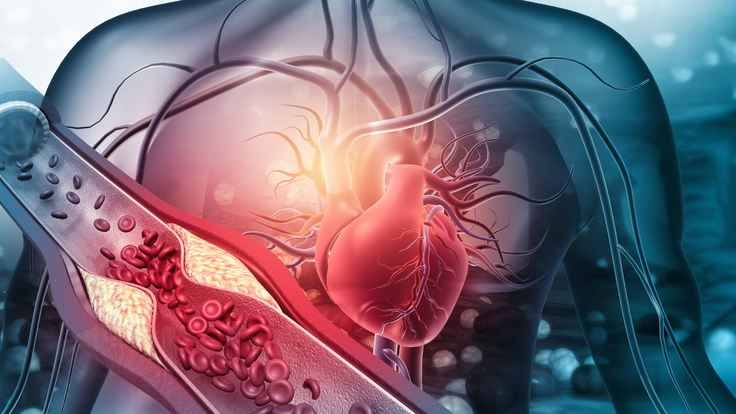 Heart & Hypertension